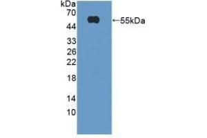 Detection of Recombinant TREM2, Mouse using Polyclonal Antibody to Triggering Receptor Expressed On Myeloid Cells 2 (TREM2)