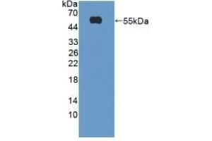 Detection of Recombinant TREM2, Mouse using Polyclonal Antibody to Triggering Receptor Expressed On Myeloid Cells 2 (TREM2) (TREM2 anticorps  (AA 1-227))