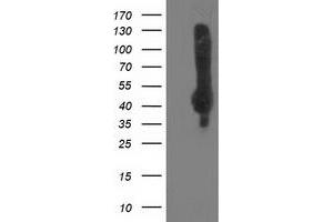 Western Blotting (WB) image for anti-Sialidase 2 (Cytosolic Sialidase) (NEU2) antibody (ABIN1499694) (NEU2 anticorps)