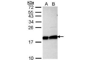 WB Image Sample (30 ug of whole cell lysate) A: Hela B: Hep G2 , 12% SDS PAGE antibody diluted at 1:1000 (UBE2L3 anticorps  (C-Term))