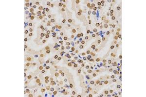 Immunohistochemistry of paraffin-embedded mouse kidney tissue using H3K36me2 antibody at dilution of 1:200 (x400 lens)