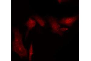 ABIN6269395 staining HT29 by IF/ICC.