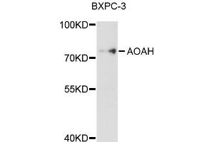 Western blot analysis of extracts of BxPC-3 cells, using AOAH antibody (ABIN5997236) at 1/1000 dilution.