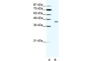 WB Suggested Anti-LDB2 Antibody Titration:  1. (LIM Domain Binding 2 Protein anticorps  (C-Term))