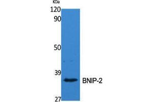 Western Blot (WB) analysis of specific cells using BNIP-2 Polyclonal Antibody. (BNIP2 anticorps  (Internal Region))