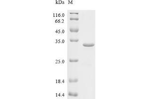 (Tris-Glycine gel) Discontinuous SDS-PAGE (reduced) with 5 % enrichment gel and 15 % separation gel.