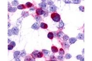 HEK293 expressing transfected CCR7