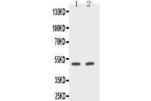 Anti-CD2 antibody, Western blotting Lane 1: Rat Spleen Cell Lysate Lane 2: NIH/3T3 Cell Lysate (CD2 anticorps  (Middle Region))