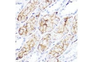Immunohistochemistry of paraffin-embedded human kidney using Aquaporin-1  Rabbit pAb (ABIN7265651) at dilution of 1:100 (40x lens).