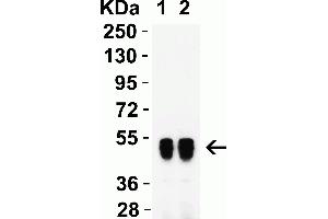Western Blot Validation with Human Recombinant Protein. (SARS-CoV-2 Nucleocapsid anticorps)