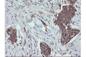 Image no. 5 for anti-Ras Homolog Gene Family, Member J (RHOJ) antibody (ABIN1501341)