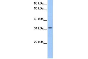 WB Suggested Anti-C14orf140 Antibody Titration: 0. (ZC2HC1C anticorps  (N-Term))