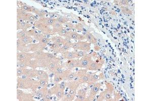 Immunohistochemistry of paraffin-embedded Human liver using DBH Polyclonal Antibody at dilution of 1:200 (40x lens). (DBH anticorps)