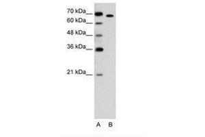 Image no. 2 for anti-RAR-Related Orphan Receptor A (RORA) (AA 239-288) antibody (ABIN205084)
