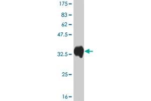 Western Blot detection against Immunogen (33. (ATOX1 anticorps  (AA 1-68))