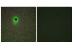 Immunofluorescence analysis of A549 cells, using HIPK4 antibody. (HIPK4 anticorps  (C-Term))