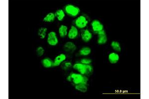 Immunofluorescence of monoclonal antibody to FOXA1 on A-431 cell. (FOXA1 anticorps  (AA 367-472))
