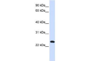 WB Suggested Anti-C20orf103 Antibody Titration:  0. (LAMP5 anticorps  (Middle Region))