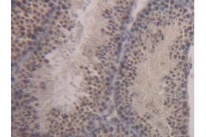 DAB staining on IHC-P; Samples: Mouse Testis Tissue (STAT1 anticorps  (AA 432-680))