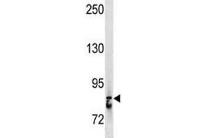STAT3 antibody western blot analysis in A375 lysate.
