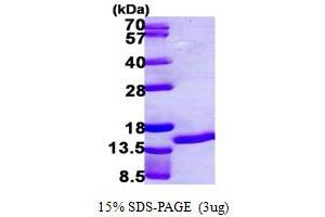 SDS-PAGE (SDS) image for S100 Calcium Binding Protein A7 (S100A7) (AA 1-101) protein (His tag) (ABIN667405)