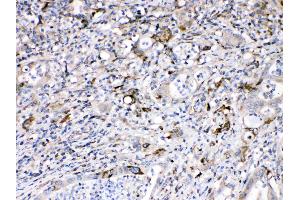 IHC analysis of Bax using anti-Bax antibody . (BAX anticorps  (N-Term))