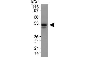 Western blot analysis of Plin3 in 3T3-L1 lysate using Plin3 polyclonal antibody . (PLIN3 anticorps  (AA 1-100))
