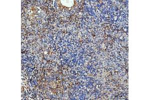 IHC analysis of ICAM1 using anti-ICAM1 antibody (ABIN5692991). (ICAM1 anticorps  (AA 28-268))