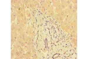 Immunohistochemistry of paraffin-embedded human liver tissue using ABIN7165948 at dilution of 1:100 (PPM1H anticorps  (AA 73-289))