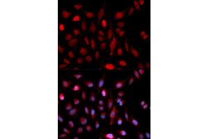 Immunofluorescence (IF) image for anti-Set1/Ash2 Histone Methyltransferase Complex Subunit ASH2 (ASH2L) antibody (ABIN1876580) (ASH2L anticorps)
