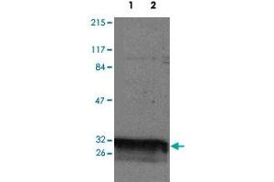 Western blot analysis of YWHAQ expression in HeLa (Lane 1) and Jurkat (Lane 2) whole cell lysates. (14-3-3 theta anticorps)