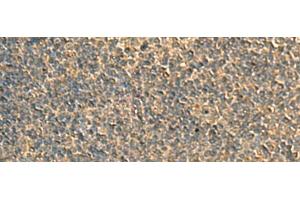 Immunohistochemistry of paraffin-embedded Human tonsil tissue using RPS11 Polyclonal Antibody at dilution of 1:40(x200)