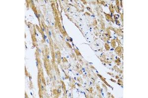 Immunohistochemistry of paraffin-embedded rat heart using GOLM1 antibody.