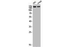 Western Blot analysis of VEC HY929 cells using Phospho-HDAC5 (S498) Polyclonal Antibody