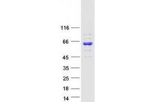 Validation with Western Blot