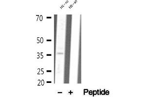 Western blot analysis of extracts of HL-60 cells, using MDH1 antibody. (MDH1 anticorps  (C-Term))