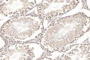 Immunohistochemistry analysis of paraffin-embedded mouse testis using,TBXT (ABIN7075815) at dilution of 1: 3200