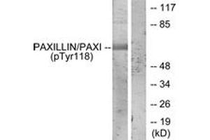 Western blot analysis of extracts from HeLa cells treated with EGF, using Paxillin (Phospho-Tyr118) Antibody. (Paxillin anticorps  (pTyr118))