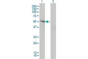 Western Blot analysis of SMAD3 expression in transfected 293T cell line by SMAD3 monoclonal antibody (M01), clone 2C12.