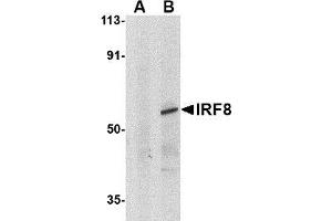 Western blot analysis of IRF8 in human thymus tissue lysate with AP30451PU-N IRF8 antibody at 1μg/ml in (A) the presence and (B) absence of blocking peptide. (IRF8 anticorps)