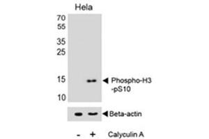 Western blot analysis of lysate from HeLa cell line, untreated or treated with Calyculin A (100ng/ml), using phospho-Histone H3 antibody