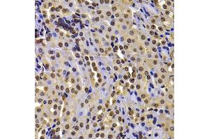Immunohistochemistry of paraffin-embedded mouse kidney using WHSC1 antibody at dilution of 1:100 (40x lens). (WHSC1 anticorps)