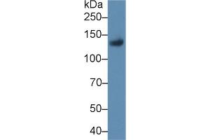 Western blot analysis of Rat Placenta lysate, using Rat LIFR Antibody (1 µg/ml) and HRP-conjugated Goat Anti-Rabbit antibody ( (LIFR anticorps  (AA 642-791))