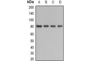 Western blot analysis of BBS2 expression in mouse testis (A), mouse kidney (B), rat liver (C), rat brain (D) whole cell lysates. (BBS2 anticorps)
