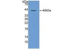 Detection of Recombinant MIP1a, Rat using Polyclonal Antibody to Macrophage Inflammatory Protein 1 Alpha (MIP1a) (CCL3 anticorps  (AA 24-92))