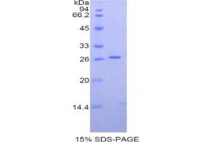 SDS-PAGE analysis of Human SIGLEC2 Protein. (CD22 Protéine)