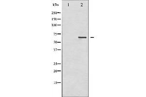 Western blot analysis of LIMK2 phosphorylation expression in NIH-3T3 whole cell lysates,The lane on the left is treated with the antigen-specific peptide.