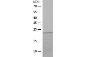 Western Blotting (WB) image for RAB4A, Member RAS Oncogene Family (RAB4A) (AA 1-218) protein (His-IF2DI Tag) (ABIN7124758)
