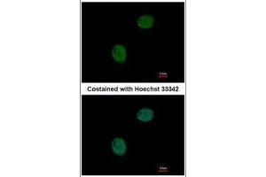ICC/IF Image Immunofluorescence analysis of paraformaldehyde-fixed HeLa, using GNAT2, antibody at 1:500 dilution. (GNAT2 anticorps  (Center))