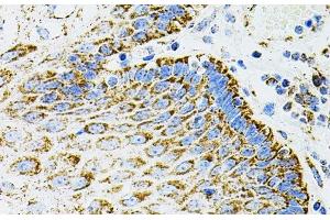 Immunohistochemistry of paraffin-embedded Human esophagus using EPO Polyclonal Antibody
